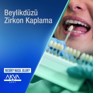 Beylikdüzü Zirkon Kaplama