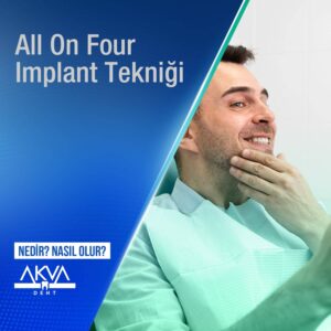 All On Four Implant Tekniği Nedir?