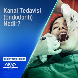 Kanal Tedavisi (Endodonti)