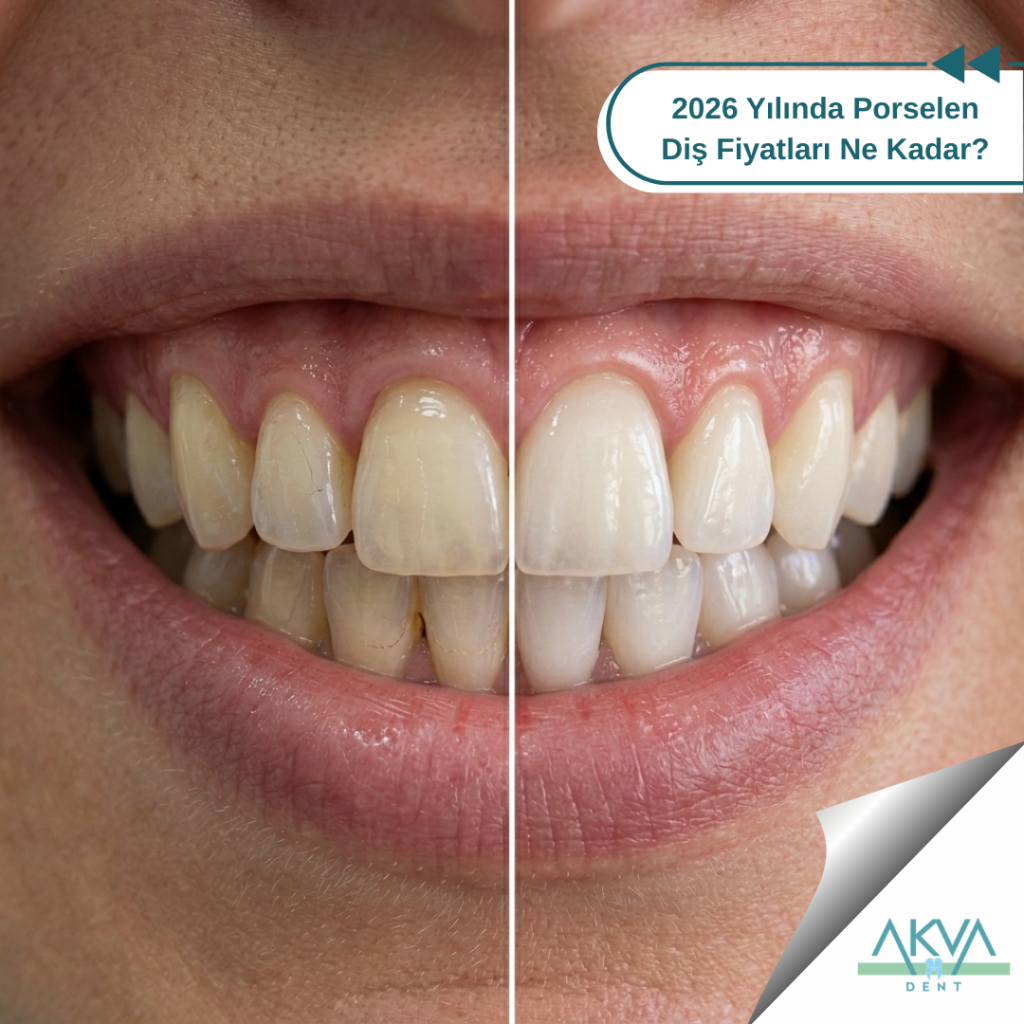 2026 porselen diş fiyatları ne kadar