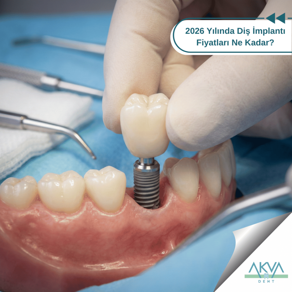 2026 Yılında Diş İmplantı Fiyatları Ne Kadar