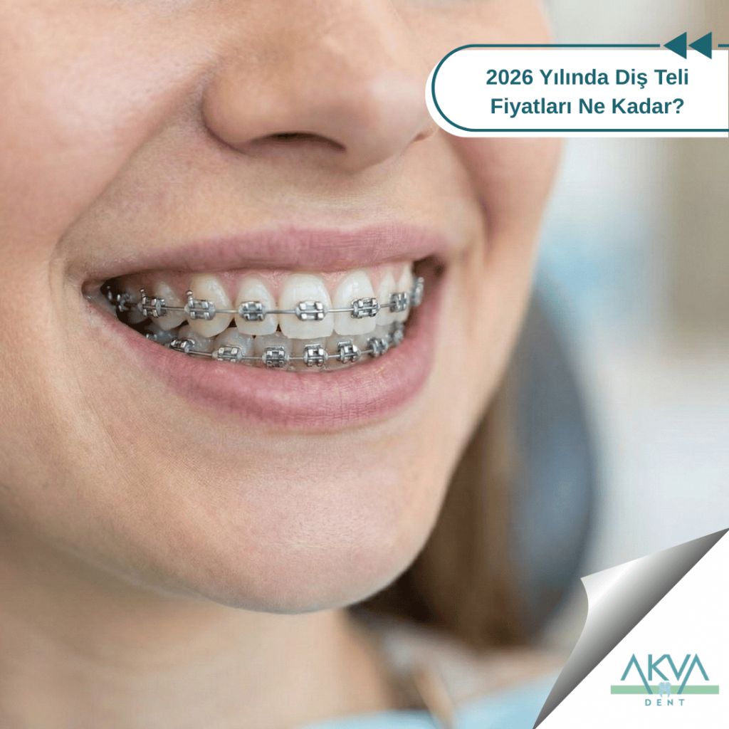 2026 Yılında Diş Teli Fiyatları Ne Kadar