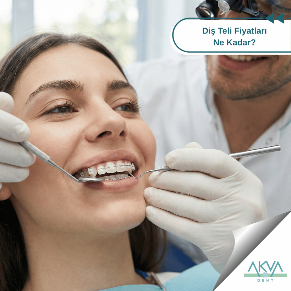 Diş Teli Fiyatları Ne Kadar