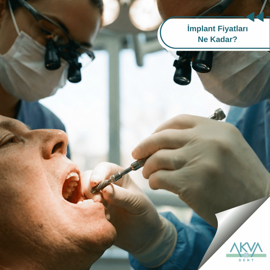 İmplant Fiyatları Ne Kadar